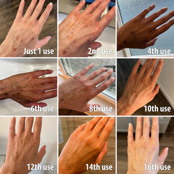 đBee Poison & Ocean Natural Eczema Psoriasis Relief Cream (For all skin conditions)