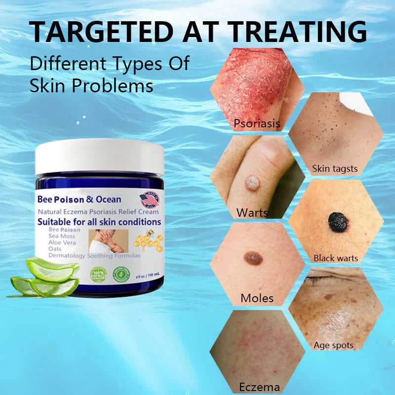 đBee Poison & Ocean Natural Eczema Psoriasis Relief Cream (For all skin conditions)