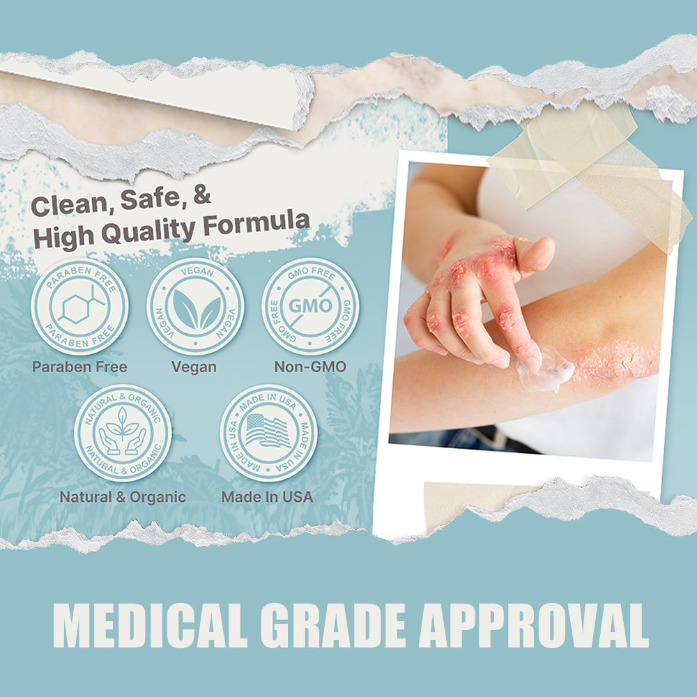 đBee Poison & Ocean Natural Eczema Psoriasis Relief Cream (For all skin conditions)