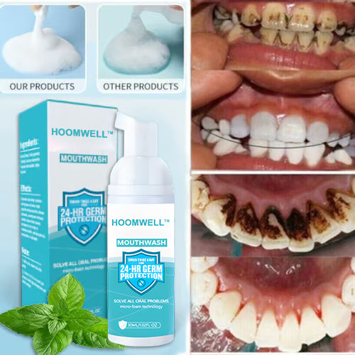 🎅 Christmas Special 50% Off ☃️HOOMWELL™Mouth Cleaning Mousse