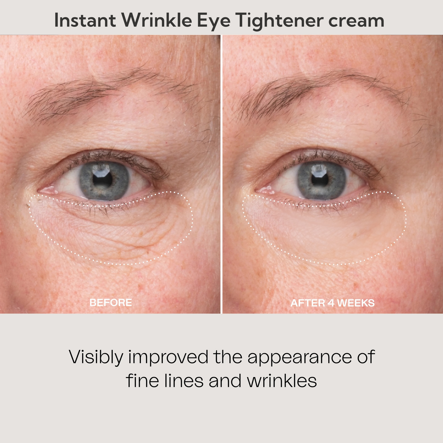 🎅 Christmas Special 50% Off ☃️ Instant Wrinkle Eye Tightener Cream